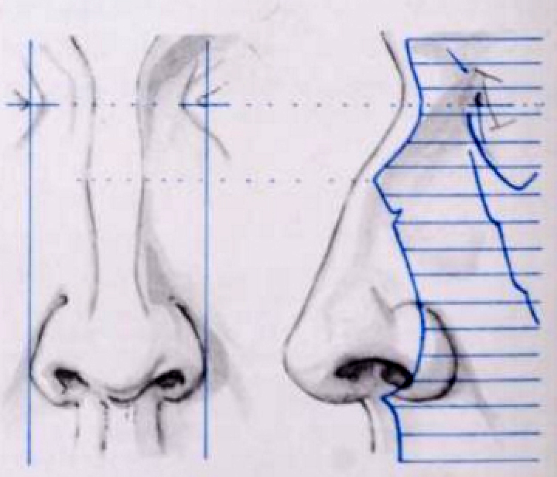 humanform-06-noses